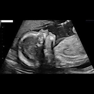 Meet your Posher, Cristy